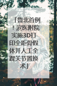 鲁北首例！滨医附院实施3D打印全距骨假体并人工全踝关节置换术